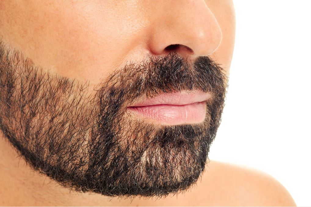 Male Full Body Electrolysis Beards Cheeks Back Shoulders